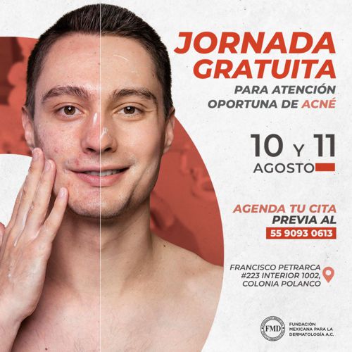 Jornada gratuita acné